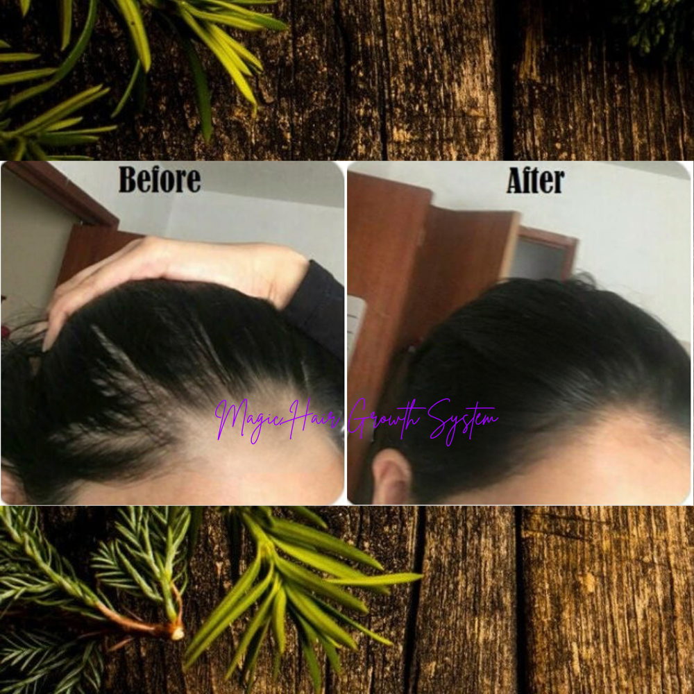 MAGIC Hair Growth Serum