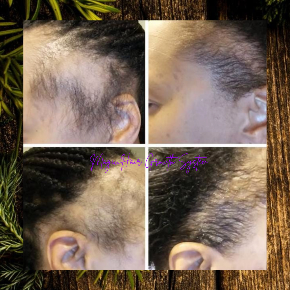 MAGIC Hair Growth Serum