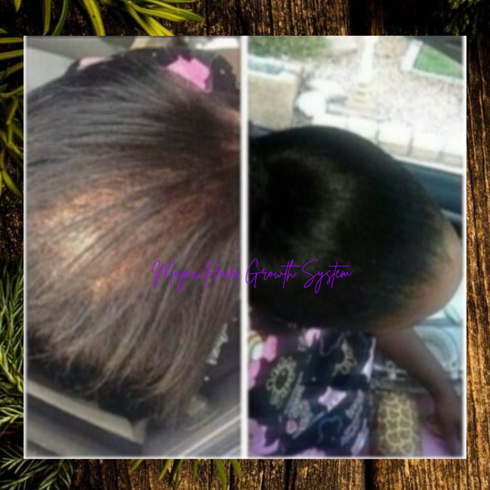 MAGIC Hair Growth Serum