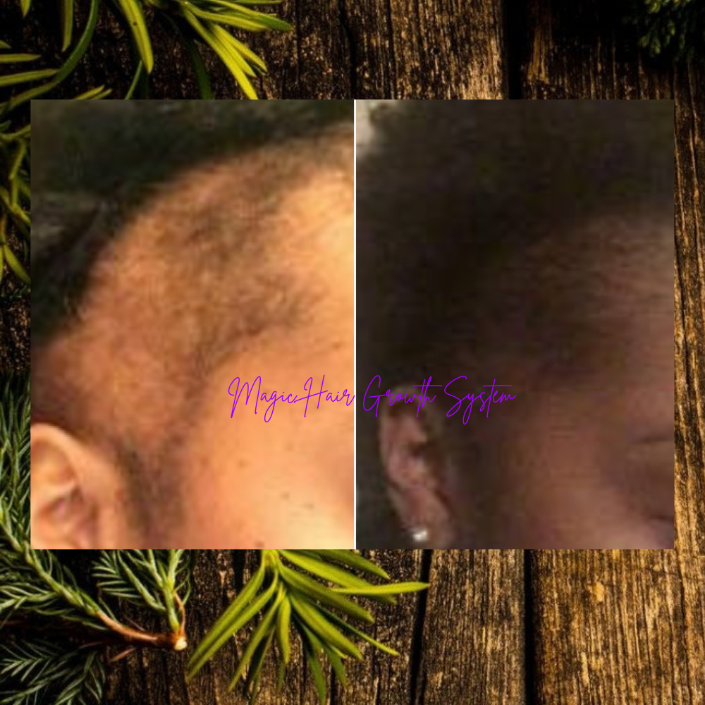 MAGIC Hair Growth Serum