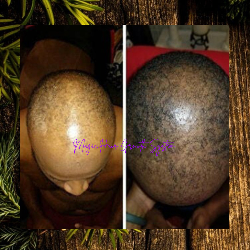 MAGIC Hair Growth Serum